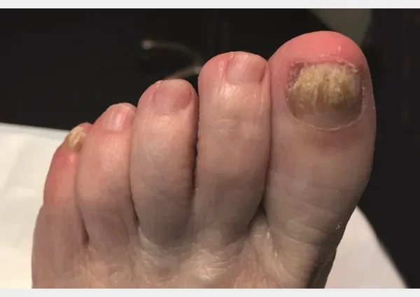 Foot trooper : σύνθεση μόνο φυσικά συστατικά.